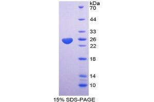 SDS-PAGE analysis of Mouse HABP1 Protein. (C1QBP Protein)