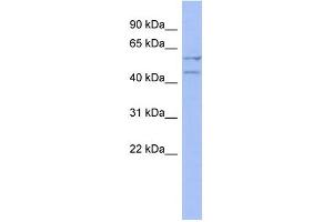 WB Suggested Anti-DAZ4 Antibody Titration:  0. (DAZ4 Antikörper  (Middle Region))