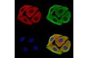 ABIN7094499 and ABIN7098548 staining Hela cells by IF/ICC. (SAA2 Antikörper  (Internal Region))