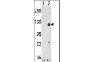 Western Blotting (WB) image for anti-PTK2 Protein tyrosine Kinase 2 (PTK2) (AA 396-423) antibody (ABIN1882121)