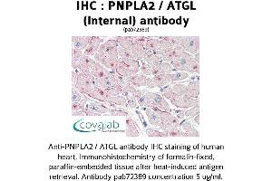 Image no. 1 for anti-Patatin-Like phospholipase Domain Containing 2 (PNPLA2) (Internal Region) antibody (ABIN1738173) (PNPLA2 Antikörper  (Internal Region))
