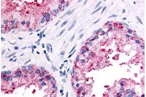 Immunohistochemical (Formalin/PFA-fixed paraffin-embedded sections) staining in human prostate, epithelium with OR51E2 polyclonal antibody . (PSGR Antikörper  (Extracellular Domain))