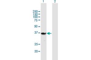 Western Blot analysis of QPRT expression in transfected 293T cell line by QPRT MaxPab polyclonal antibody. (QPRT Antikörper  (AA 1-297))