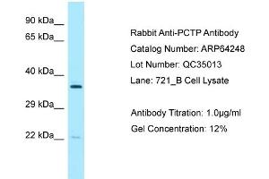 Western Blotting (WB) image for anti-Phosphatidylcholine Transfer Protein (PCTP) (Middle Region) antibody (ABIN2789778) (PCTP Antikörper  (Middle Region))