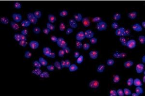 IF analysis of RRS1 using anti-RRS1 antibody (ABIN7601344). (RRS1 Antikörper  (AA 33-266))