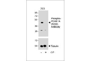 Western blot analysis of lysates from 293 cell line, untreated or treated with CIP, 100 ng/mL, using Phospho-PDHE1A Antibody (upper) or Tubulin (lower). (Pyruvate Dehydrogenase E1 alpha (pSer232) Antikörper)