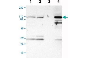 Western Blot analysis of Lane 1: RT-4, Lane 2: U-251MG sp, Lane 3: human plasma (IgG/HSA depleted) and Lane 4: human liver lysates with PYGL polyclonal antibody . (PYGL Antikörper)