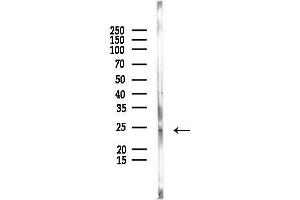 Western blot analysis of lysates from Mouse kidney, using TMEM126A Antibody at 1/1000 dilution. (TMEM126A Antikörper)