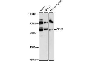 Western blot analysis of extracts of various cell lines, using CPSF7 antibody (ABIN6292490) at 1:3000 dilution. (CPSF7 Antikörper)