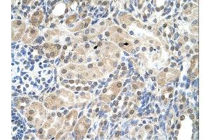 Immunohistochemistry (IHC) image for anti-Solute Carrier Family 9, Subfamily A (NHE9, Cation Proton Antiporter 9), Member 9 (SLC9A9) (C-Term) antibody (ABIN2781738) (SLC9A9 Antikörper  (C-Term))