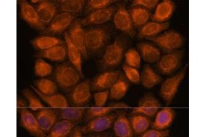 Immunofluorescence analysis of HeLa cells using SNX15 Polyclonal Antibody at dilution of 1:100. (SNX15 Antikörper)