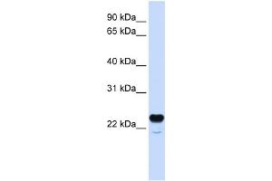 WB Suggested Anti-C1QTNF1 Antibody Titration:  0.