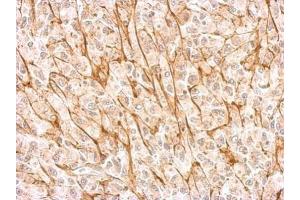 IHC-P Image NMDAR2A antibody detects GRIN2A protein at membrane on U87 xenograft by immunohistochemical analysis.