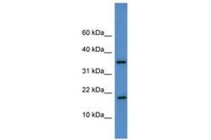 WW Domain Binding Protein 5 (WBP5) (AA 44-93) anticorps