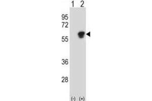 Western Blotting (WB) image for anti-Nucleosome Assembly Protein 1-Like 1 (NAP1L1) antibody (ABIN3000775) (NAP1L1 Antikörper)