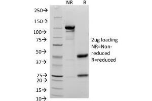 SDS-PAGE Analysis Purified CD48 Mouse Monoclonal Antibody (156-4H9). (CD48 Antikörper)