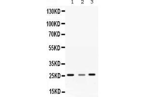 Western blot analysis of SRI expression in rat liver extract ( Lane 1), rat brain extract ( Lane 2) and SMMC7721 whole cell lysates ( Lane 3). (SRI Antikörper  (Middle Region))
