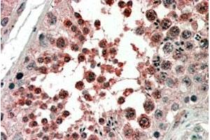 ACVR1 polyclonal antibody (4 ug/mL) staining of paraffin embedded human testis.