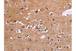 The image on the left is immunohistochemistry of paraffin-embedded Human brain tissue using ABIN7190535(EGR4 Antibody) at dilution 1/20, on the right is treated with synthetic peptide. (EGR4 Antikörper)