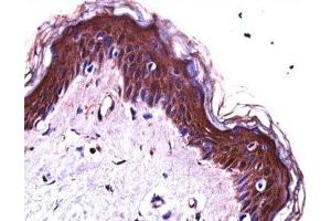 S100A7 antibody immunohistochemistry analysis in formalin fixed and paraffin embedded human skin tissue. (S100A7 Antikörper  (AA 2-31))