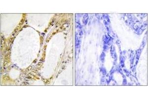 Immunohistochemistry (IHC) image for anti-Interferon Regulatory Factor 2 (IRF2) (AA 101-150) antibody (ABIN1533619)
