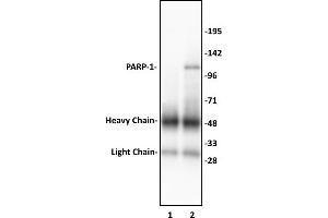 PARP-1 N-terminal antibody (pAb) tested by Immunoprecipitation. (PARP1 Antikörper  (N-Term))