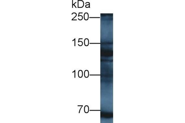 MYT1 anticorps  (AA 905-1127)