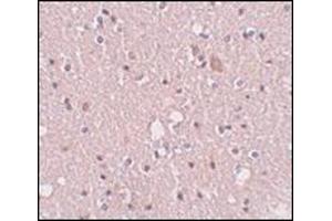 Immunohistochemistry of SIPA1L2 in human brain tissue with this product at 5 μg/ml.