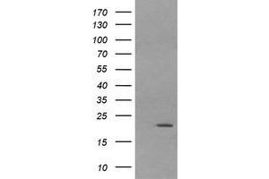 Image no. 7 for anti-Leucine Zipper and CTNNBIP1 Domain Containing (LZIC) antibody (ABIN1499239)