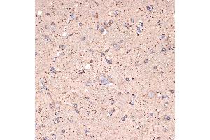 Immunohistochemistry of paraffin-embedded rat brain using GABA transaminase (GABA transaminase (ABAT)) Rabbit mAb (ABIN7265336) at dilution of 1:100 (40x lens). (ABAT Antikörper)