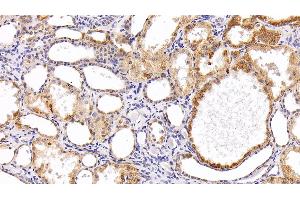Immunohistochemistry (IHC) image for anti-Eosinophil Cationic Protein (ECP) (AA 30-154) antibody (ABIN7434023)