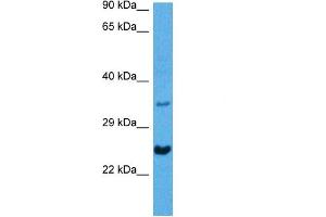 Host:  Mouse  Target Name:  NKX2-5  Sample Tissue:  Mouse Heart  Antibody Dilution:  1ug/ml (NK2 Homeobox 5 Antikörper  (N-Term))
