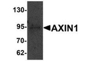 Western blot analysis of AXIN1 in SK-N-SH cell lysate with AXIN1 antibody at 1 μg/ml. (Axin Antikörper  (C-Term))