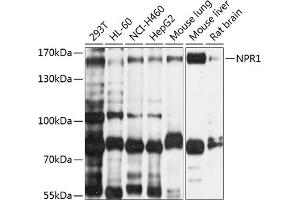 Western Blotting (WB) image for anti-Natriuretic Peptide Receptor A/guanylate Cyclase A (Atrionatriuretic Peptide Receptor A) (NPR1) (AA 260-470) antibody (ABIN6144783)