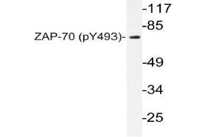 Western blot (WB) analyzes of p-ZAP-70 in extracts from Jurkat cells. (ZAP70 Antikörper  (pTyr493))
