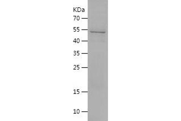 HLA-E Protein (AA 22-305) (His-IF2DI Tag)