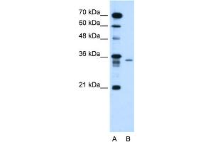 WB Suggested Anti-C6orf21 Antibody Titration:  1. (LY6G6F Antikörper  (N-Term))