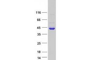 Dimethylarginine Dimethylaminohydrolase 1 (DDAH1) (Transcript Variant 1) protein (Myc-DYKDDDDK Tag)