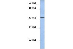WB Suggested Anti-YIPF1 Antibody Titration:  0. (YIPF1 Antikörper  (Middle Region))
