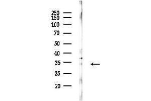 anti-General Transcription Factor IIE, Polypeptide 2 (GTF2E2) (Internal Region) antibody