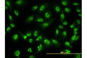 Image no. 2 for anti-Adrenocortical Dysplasia Homolog (ACD) (AA 1-545) antibody (ABIN599297) (ACD Antikörper  (AA 1-545))