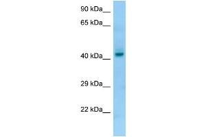 WB Suggested Anti-PGA4 Antibody Titration: 1.