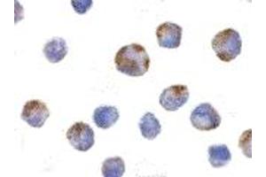 Immunohistochemistry (IHC) image for anti-NLR Family, Pyrin Domain Containing 1 (NLRP1) (C-Term) antibody (ABIN1030530) (NLRP1 Antikörper  (C-Term))