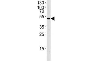 Western blot analysis of lysate from MCF-7 cell line using SOCS4 antibody diluted at 1:1000 for each lane. (SOCS4 Antikörper  (AA 227-254))