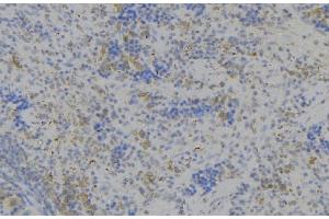 ABIN6279516 at 1/100 staining Human lymph node tissue by IHC-P. (LILRB2 Antikörper)