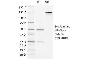 SDS-PAGE Analysis of Purified, BSA-Free vWF Antibody (clone VWF/1465). (VWF Antikörper  (AA 1815-1939))
