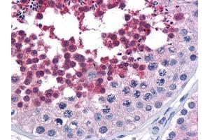 Immunohistochemical analysis of paraffin-embedded human Testis tissues using anti-CDC25C mouse mAb (CDC25C Antikörper)