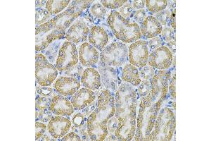Immunohistochemistry of paraffin-embedded mouse kidney using AP2A1 Antibody (ABIN5975765) at dilution of 1/100 (40x lens). (alpha Adaptin Antikörper)