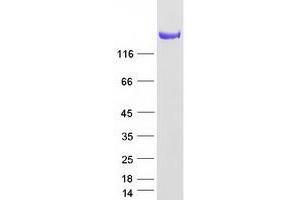 Validation with Western Blot