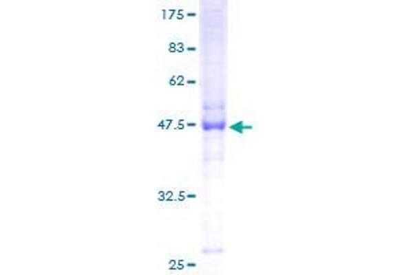 Nucleolar Protein 6 Protein (NOL6) (AA 1-200) (GST tag)